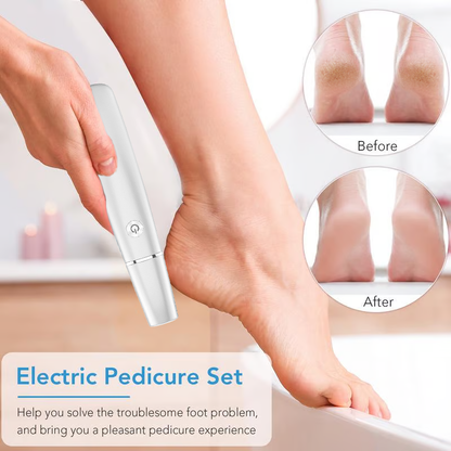 🔥Christmas Special Price ￡10.99⚡50K+ SOLD!❤️Electric Feet Callus Remover⚡