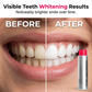 🦷 Surprise Price: Only £9.99!!🔥 ⚡ Stain‑Removing Whitening Mouthwash – Deep Clean Stains, Brighten Teeth & Freshen Breath Instantly ✨